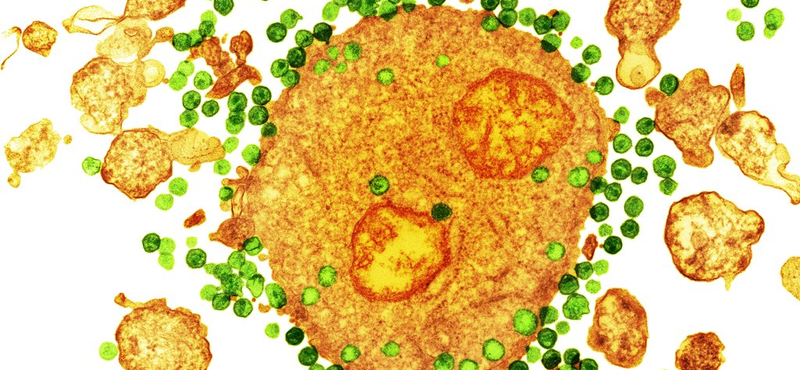 Bebizonyították: működik a HIV-fertőzést gátló terápia