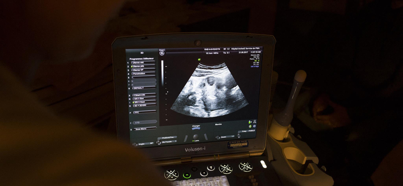 Az Európa Tanács elítélte az új magyar abortuszrendeletet