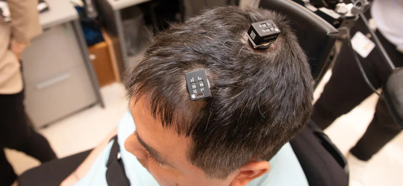 15 órás műtéttel, agyimplantátummal és MI-vel érték el orvosok, hogy egy lebénult férfi újra mozgathassa a karját, és érezhesse az érintéseket